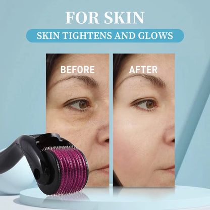Microneedling Derma Roller