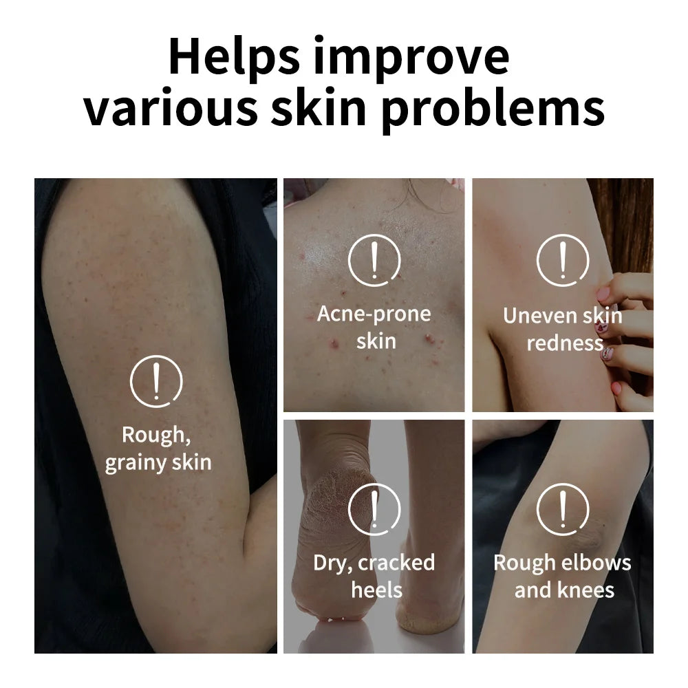Lakerain Glycolic Acid Exfoliating Body Stick