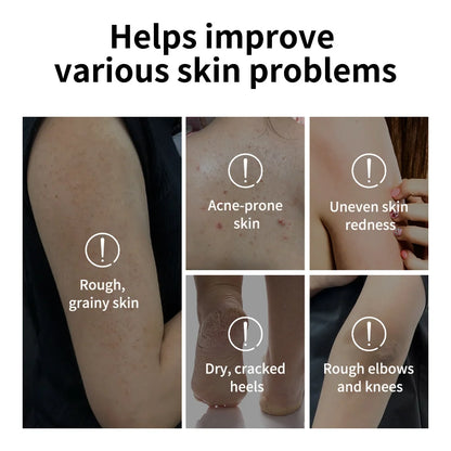 Lakerain Glycolic Acid Exfoliating Body Stick