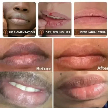 Moisturizing Exfoliating Lip Care Balm
