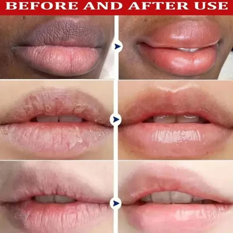 Moisturizing Exfoliating Lip Care Balm