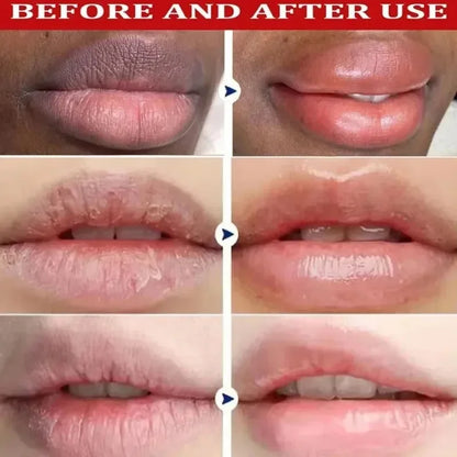 Moisturizing Exfoliating Lip Care Balm